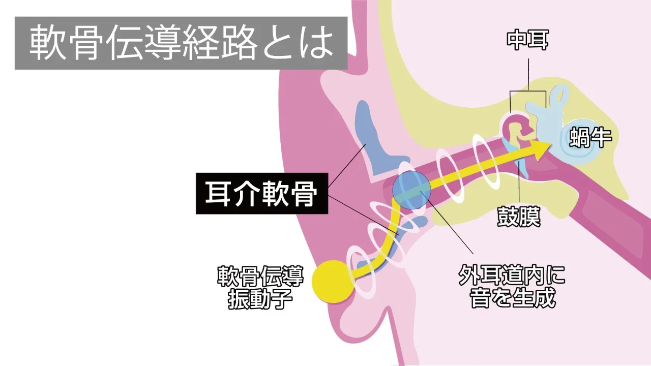 軟骨伝導経路の仕組みを示す耳の断面図