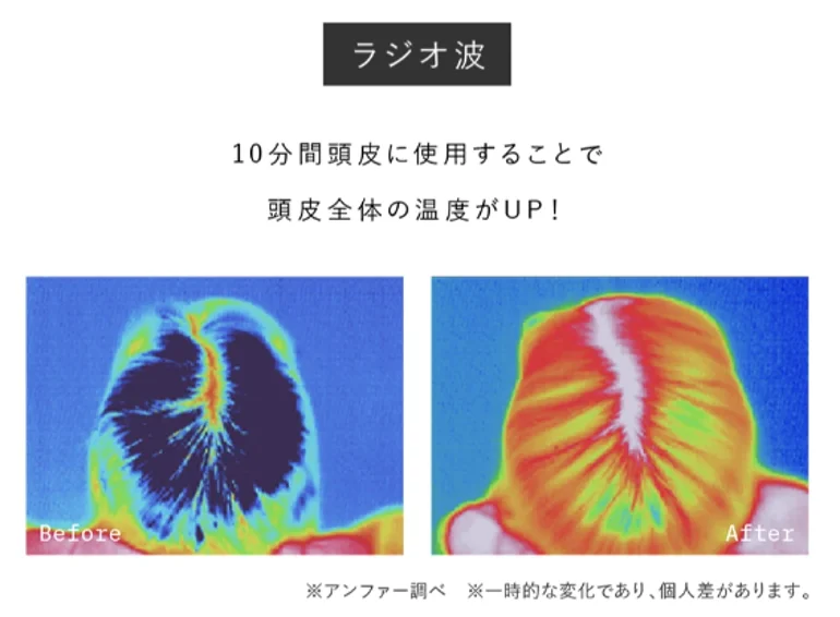スカルプ電気ブラシのラジオ波使用前後の頭皮温度変化を示すサーモグラフィー