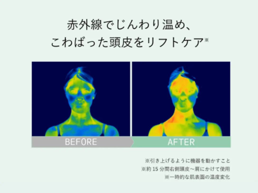 ビューティーヘッドスパ使用前後のサーモグラフィー比較画像
